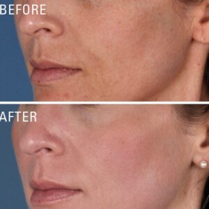 Kem Dưỡng Trắng Da, Mờ Nám ZO® Skin Health Skin Brightener 0.5% Retinol - Image 5