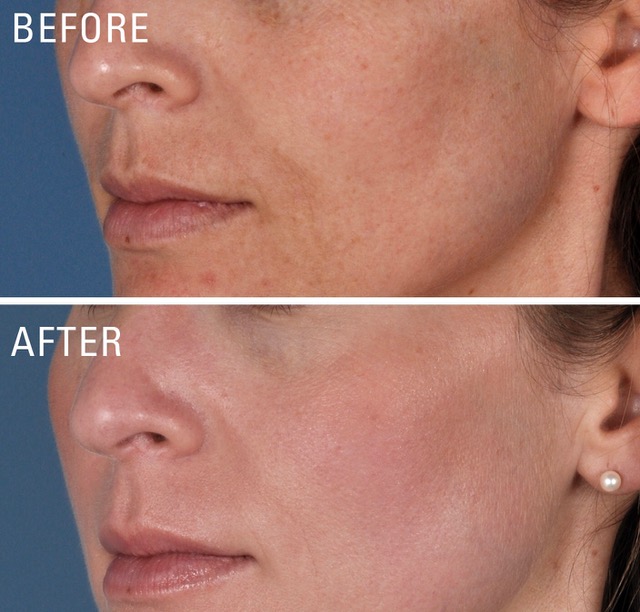 Kem Dưỡng Trắng Da, Mờ Nám ZO® Skin Health Skin Brightener 0.5% Retinol - Image 5