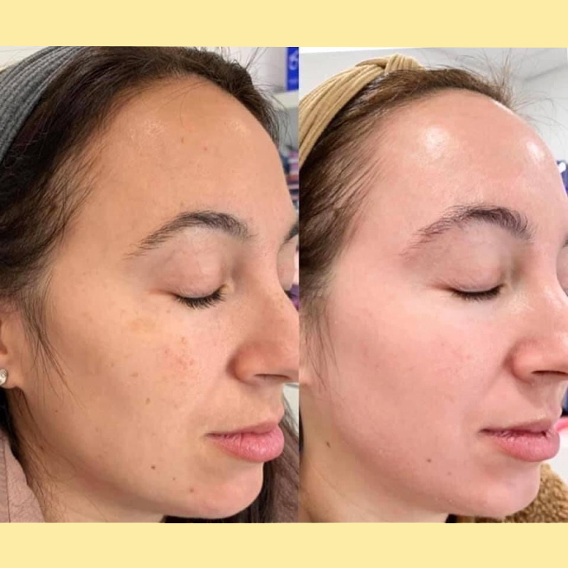 Kem Phục Hồi Da ZO® Skin Health Daily Power Defense - Image 7