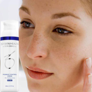 Kem Trị Nám Cho Mọi Loại Da ZO® Skin Health Pigment Control Crème - Image 4