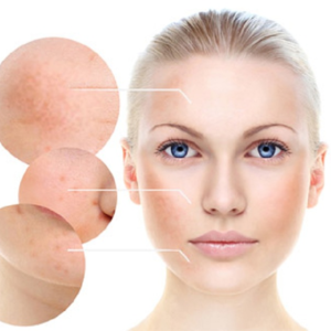 Kem Trị Nám Cho Mọi Loại Da ZO® Skin Health Pigment Control Crème - Image 7