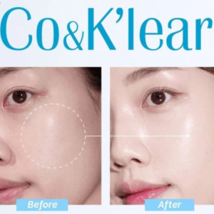 Serum B5 + HA dưỡng ẩm phục hồi Co & K’lear 50ml - Image 5